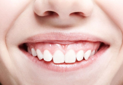 Cắt Lợi Là Gì? Có Đau Không Và Những Ai Nên Thực Hiện